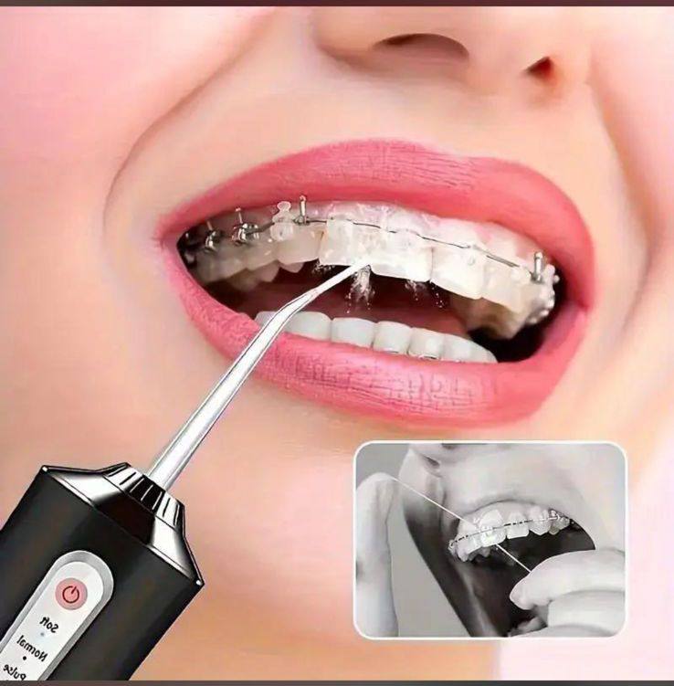LIMPIADOR DENTAL IRRIGADOR